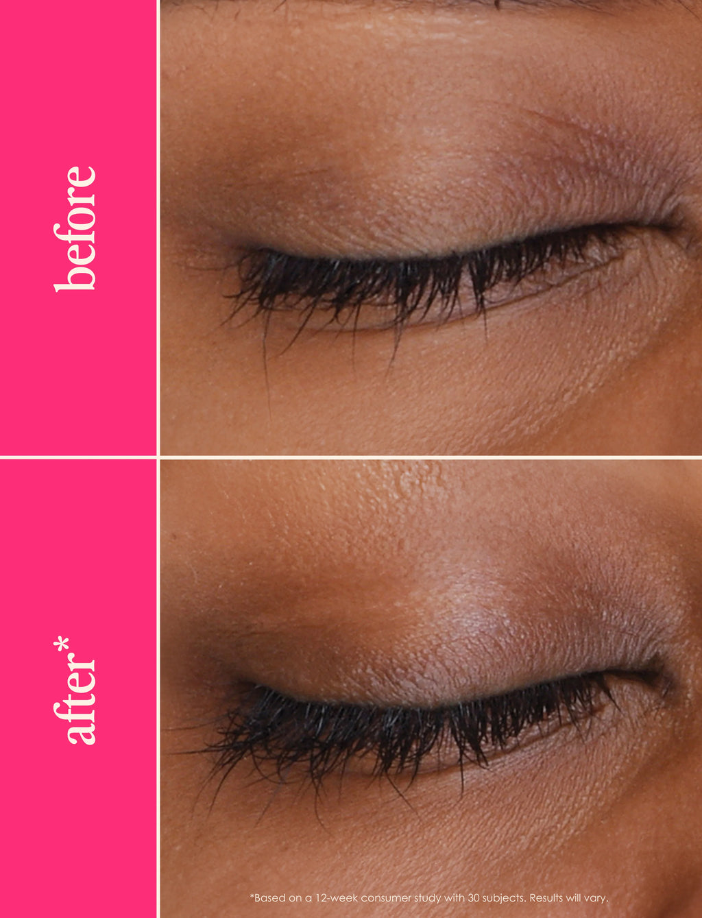 GrandeLash MD - Lash Enhancing Serum