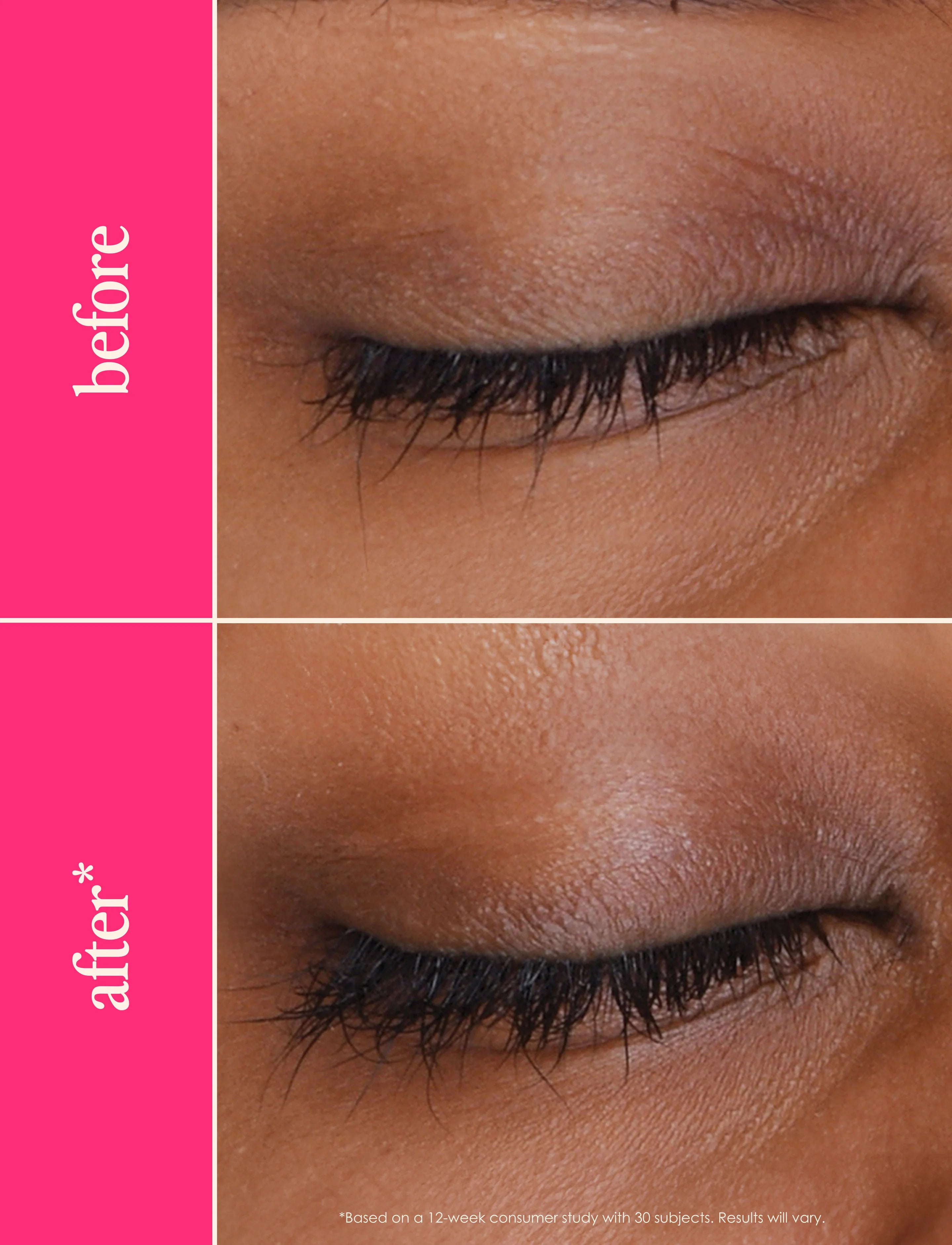 GrandeLash MD - Lash Enhancing Serum